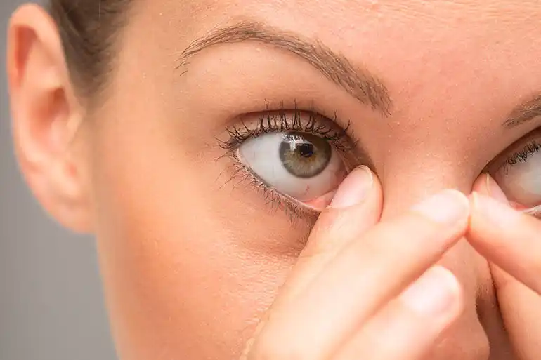 Dry eye care and treatment