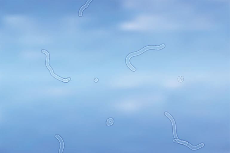 Eye floaters and flashes