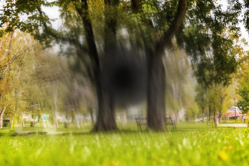 Macular degeneration vision comparison
